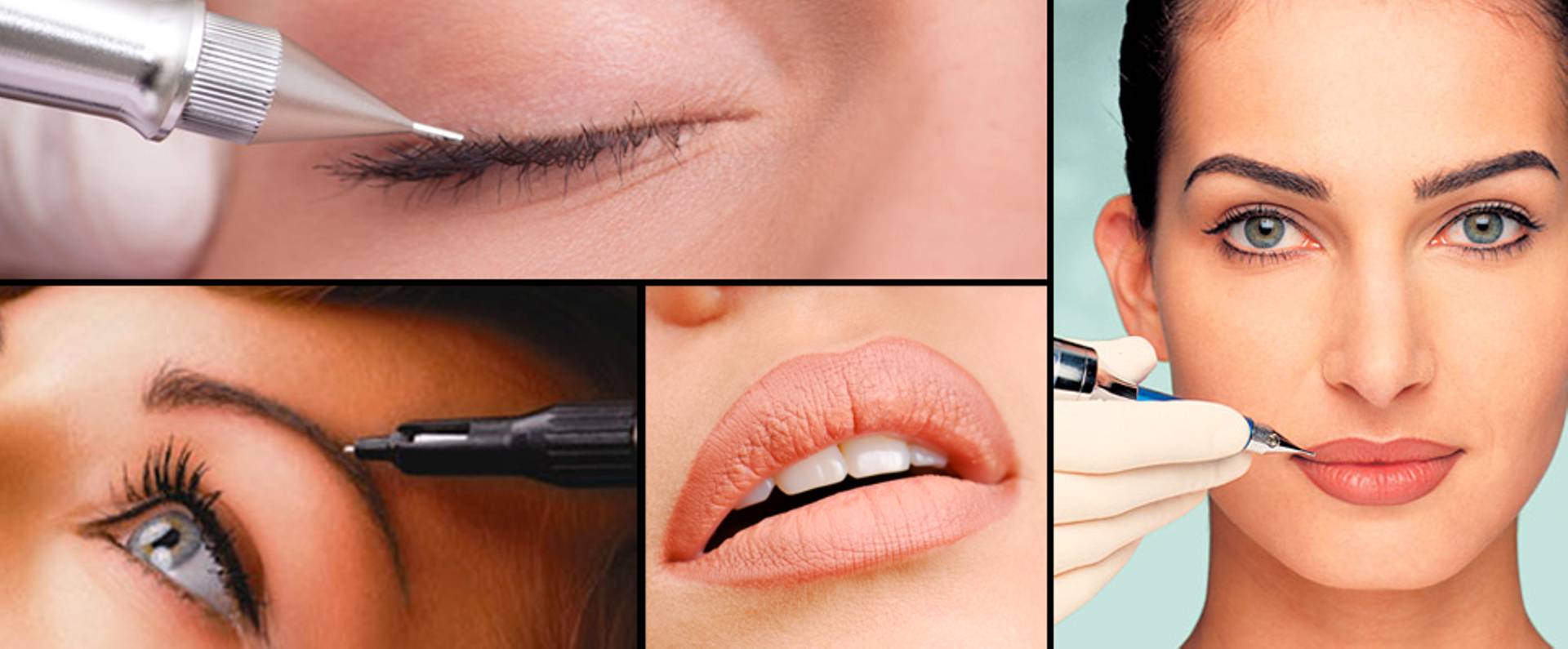 میکروپیگمنتیشن صورت